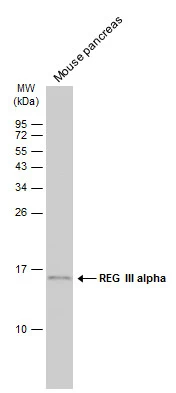 Mouse tissue extract (50 μg) was separated by 15% SDS-PAGE, and the membrane was blotted with REG III alpha antibody [C1C3] (GTX108275) diluted at 1:500. The HRP-conjugated anti-rabbit IgG antibody (GTX213110-01) was used to detect the primary antibody, and the signal was developed with Trident ECL plus-Enhanced.