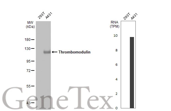 Various whole cell extracts (30 μg) were separated by 7.5% SDS-PAGE, and the membrane was blotted with Thrombomodulin antibody [C3], C-term (GTX108277) diluted at 1:500. The HRP-conjugated anti-rabbit IgG antibody (GTX213110-01) was used to detect the primary antibody. Corresponding RNA expression data for the same cell lines are based on Human Protein Atlas program.