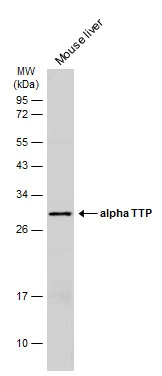 alpha TTP antibody [C2C3], C-term