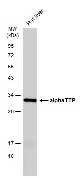 alpha TTP antibody [C2C3], C-term