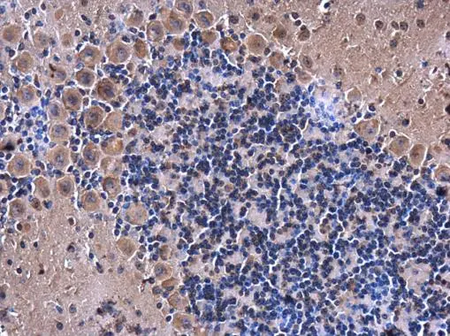 eRF1 antibody detects eRF1 protein at cytoplasm in mouse brain by immunohistochemical analysis. Sample: Paraffin-embedded mouse brain. eRF1 antibody (GTX108296) diluted at 1:500.
Antigen Retrieval: Citrate buffer, pH 6.0, 15 min eRF1 antibody detects eRF1 protein at cytoplasm in mouse brain by immunohistochemical analysis. Sample: Paraffin-embedded mouse brain. eRF1 antibody (GTX108296) diluted at 1:500.
Antigen Retrieval: Citrate buffer, pH 6.0, 15 min