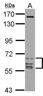Sample (20 ug of whole cell lysate) A: mouse brain 7.5% SDS PAGE GTX108304 diluted at 1:1000 Sample (20 ug of whole cell lysate) A: mouse brain 7.5% SDS PAGE GTX108304 diluted at 1:1000