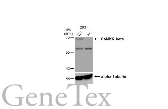 Wild-type (WT) and CaMKK beta knockout (KO) HeLa cell extracts (30 μg) were separated by 7.5% SDS-PAGE, and the membrane was blotted with CaMKK beta antibody (GTX108305) diluted at 1:500. The HRP-conjugated anti-rabbit IgG antibody (GTX213110-01) was used to detect the primary antibody.