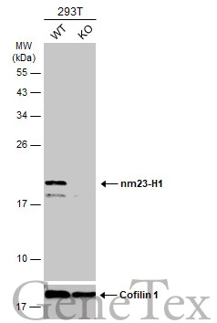 Wild-type (WT) and nm23-H1 knockout (KO) 293T cell extracts (30 μg) were separated by 12% SDS-PAGE, and the membrane was blotted with nm23-H1 antibody [C1C3] (GTX108325) diluted at 1:1000. The HRP-conjugated anti-rabbit IgG antibody (GTX213110-01) was used to detect the primary antibody.