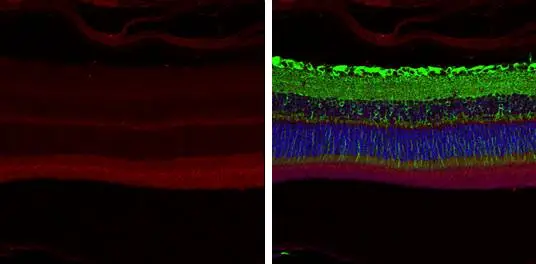 ABCA4 antibody [C3-2], C-term detects ABCA4 protein at cell membrane by immunohistochemical analysis. Sample: Paraffin-embedded mouse eye. Red: ABCA4 stained by ABCA4 antibody [C3-2], C-term (GTX108371) diluted at 1:250. Green: beta Tubulin 3/ Tuj1, a cytoskeleton marker, stained by beta Tubulin 3/ Tuj1 antibody [GT1338] (GTX631831) diluted at 1:500. Blue: Fluoroshield with DAPI (GTX30920).
 Antigen Retrieval: Citrate buffer, pH 6.0, 15 min