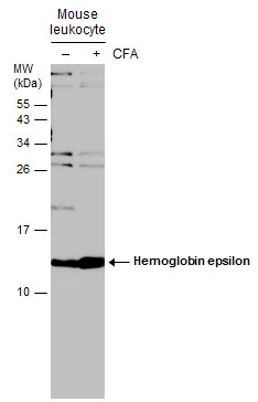 Untreated (–) and treated (+) mouse tissue extracts (30 μg) were separated by 15% SDS-PAGE, and the membrane was blotted with Hemoglobin epsilon antibody [N1N2], N-term (GTX108396) diluted at 1:500. (CFA: Complete Freunds adjuvant)