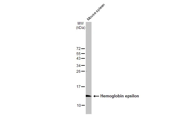 Mouse tissue extract (50 μg) was separated by 15% SDS-PAGE, and the membrane was blotted with Hemoglobin epsilon antibody [N1N2], N-term (GTX108396) diluted at 1:1000. The HRP-conjugated anti-rabbit IgG antibody (GTX213110-01) was used to detect the primary antibody.