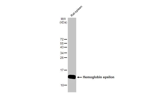 Rat tissue extract (50 μg) was separated by 15% SDS-PAGE, and the membrane was blotted with Hemoglobin epsilon antibody [N1N2], N-term (GTX108396) diluted at 1:1000. The HRP-conjugated anti-rabbit IgG antibody (GTX213110-01) was used to detect the primary antibody.
