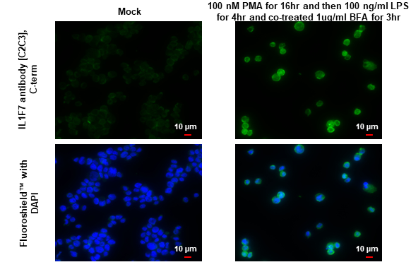 IL1F7 antibody [C2C3], C-term detects IL1F7 protein by immunofluorescent analysis. Sample: Mock and treated THP-1 cells were fixed in 4% paraformaldehyde at RT for 15 min. Green: IL1F7 stained by IL1F7 antibody [C2C3], C-term (GTX108419) diluted at 1:100. Blue: Fluoroshield with DAPI (GTX30920).