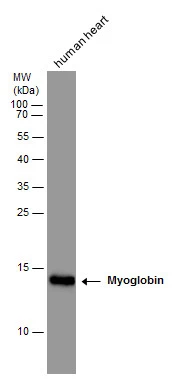 Myoglobin antibody detects Myoglobin protein by western blot analysis. Human tissue extracts (10 μg) was separated by 15 % SDS-PAGE, and the membrane was blotted with Myoglobin antibody (GTX108434) at a dilution of 1:5000.
