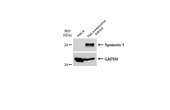 HeLa whole cell extracts and HeLa exosome extract (3.5 μg) were separated by 12% SDS-PAGE, and the membrane was blotted with Syntenin 1 antibody [C2C3], C-term (GTX108470) diluted at 1:250. The HRP-conjugated anti-rabbit IgG antibody (GTX213110-01) was used to detect the primary antibody.