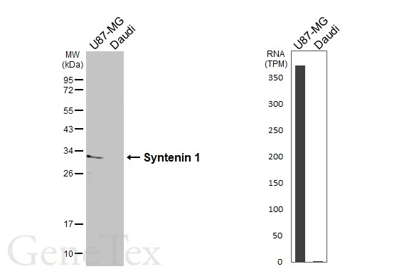 Various whole cell extracts (30 μg) were separated by 12% SDS-PAGE, and the membrane was blotted with Syntenin 1 antibody [C2C3], C-term (GTX108470) diluted at 1:1000. The HRP-conjugated anti-rabbit IgG antibody (GTX213110-01) was used to detect the primary antibody, and the signal was developed with Trident femto Western HRP Substrate. Corresponding RNA expression data are based on Human Protein Atlas program.