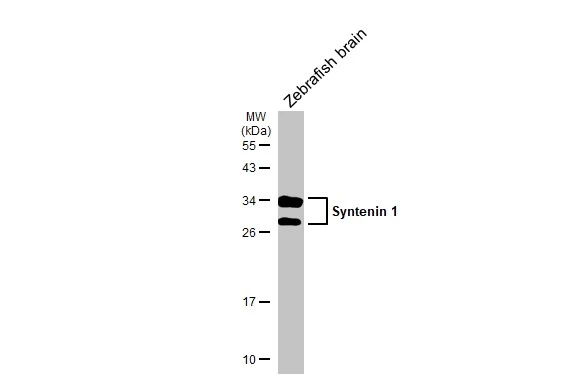 Zebrafish tissue extract (30 μg) was separated by 12% SDS-PAGE, and the membrane was blotted with Syntenin 1 antibody [C2C3], C-term (GTX108470) diluted at 1:1000. The HRP-conjugated anti-rabbit IgG antibody (GTX213110-01) was used to detect the primary antibody.