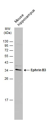 Mouse tissue extract (50 μg) was separated by 12% SDS-PAGE, and the membrane was blotted with Ephrin B3 antibody (GTX108485) diluted at 1:500. The HRP-conjugated anti-rabbit IgG antibody (GTX213110-01) was used to detect the primary antibody.