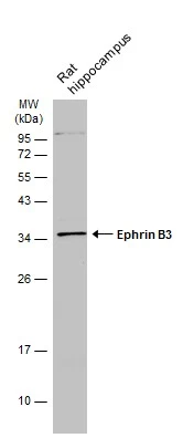 Rat tissue extract (50 μg) was separated by 12% SDS-PAGE, and the membrane was blotted with Ephrin B3 antibody [C2C3], C-term (GTX108485) diluted at 1:500. The HRP-conjugated anti-rabbit IgG antibody (GTX213110-01) was used to detect the primary antibody.