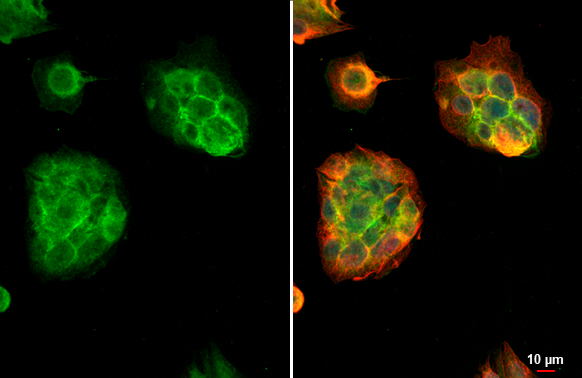 FCER1G antibody [N2C3] detects FCER1G protein at cell membrane by immunofluorescent analysis. Sample: HepG2 cells were fixed in 4% paraformaldehyde at RT for 15 min. Green: FCER1G stained by FCER1G antibody [N2C3] (GTX108487) diluted at 1:500. Red: alpha Tubulin, a cytoskeleton marker, stained by alpha Tubulin antibody [GT114] (GTX628802) diluted at 1:1000. Blue: Fluoroshield with DAPI (GTX30920). Scale bar= 10μm.