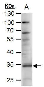 RANKL antibody [C2C3], C-term detects RANKL protein by western blot analysis. A. 50 μg rat lung extract 10% SDS-PAGE RANKL antibody [C2C3], C-term (GTX108515) dilution: 1:1000 The HRP-conjugated anti-rabbit IgG antibody (GTX213110-01) was used to detect the primary antibody.