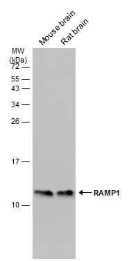 Various tissue extracts (50 μg) were separated by 15% SDS-PAGE, and the membrane was blotted with RAMP1 antibody [C1C3] (GTX108525) diluted at 1:500. The HRP-conjugated anti-rabbit IgG antibody (GTX213110-01) was used to detect the primary antibody.