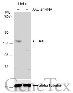 AXL antibody