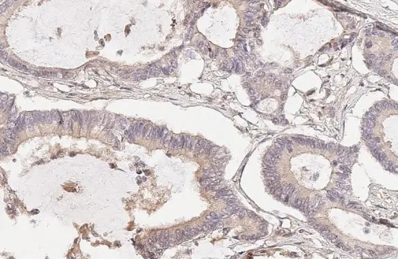 AXL antibody
