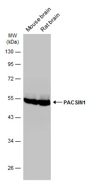 Various tissue extracts (50 μg) were separated by 10% SDS-PAGE, and the membrane was blotted with PACSIN1 antibody (GTX108567) diluted at 1:10000. The HRP-conjugated anti-rabbit IgG antibody (GTX213110-01) was used to detect the primary antibody.