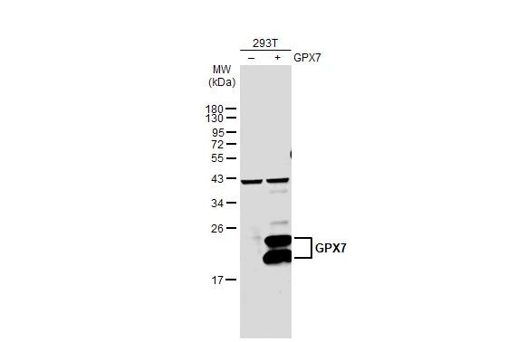Non-transfected (–) and transfected (+) 293T whole cell extracts (30 μg) were separated by 12% SDS-PAGE, and the membrane was blotted with GPX7 antibody (GTX108578) diluted at 1:500. The HRP-conjugated anti-rabbit IgG antibody (GTX213110-01) was used to detect the primary antibody. Non-transfected (–) and transfected (+) 293T whole cell extracts (30 μg) were separated by 12% SDS-PAGE, and the membrane was blotted with GPX7 antibody (GTX108578) diluted at 1:500. The HRP-conjugated anti-rabbit IgG antibody (GTX213110-01) was used to detect the primary antibody.