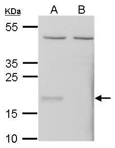 Sample (20 ug of whole cell lysate) A: Mouse embryonic fibroblast (WT) B: Mouse embryonic fibroblast(Gpx7 -/-) 12% SDS PAGE GTX108578 diluted at 1:1000 Sample (20 ug of whole cell lysate) A: Mouse embryonic fibroblast (WT) B: Mouse embryonic fibroblast(Gpx7 -/-) 12% SDS PAGE GTX108578 diluted at 1:1000