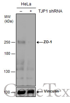 Non-transfected (–) and transfected (+) HeLa whole cell extracts (30 μg) were separated by 5% SDS-PAGE, and the membrane was blotted with ZO-1 antibody [C3], C-term (GTX108587) diluted at 1:500.