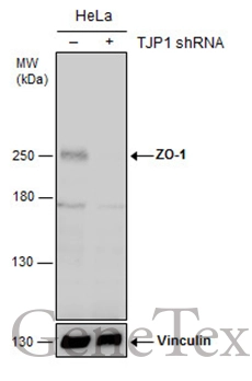 Anti-ZO-1 antibody (GTX108592) | GeneTex Anti-ZO-1 antibody (GTX108592) | GeneTex