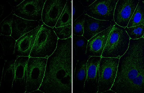 Anti-ZO-1 antibody (GTX108592) | GeneTex