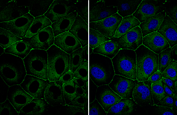 Anti-ZO-1 antibody (GTX108592) | GeneTex Anti-ZO-1 antibody (GTX108592) | GeneTex