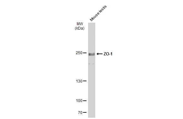 Anti-ZO-1 antibody (GTX108592) | GeneTex Anti-ZO-1 antibody (GTX108592) | GeneTex