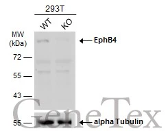 Wild-type (WT) and EphB4 knockout (KO) 293T cell extracts (30 μg) were separated by 7.5% SDS-PAGE, and the membrane was blotted with EphB4 antibody [N1N2], N-term (GTX108595) diluted at 1:500. The HRP-conjugated anti-rabbit IgG antibody (GTX213110-01) was used to detect the primary antibody.