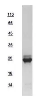 10ug of GTX108598-pro N-Ras recombinant protein analyzed using SDS-PAGE and stained with coomassie blue and captured by black and white camera.