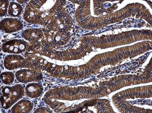 ARL14 antibody [N1C3]