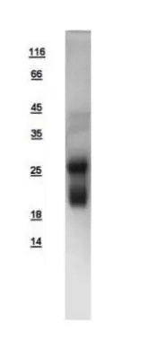 10ug of GTX108600-pro RHOB recombinant protein analyzed using SDS-PAGE and stained with coomassie blue and captured by black and white camera.