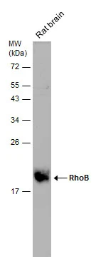 Rat tissue extract (50 μg) was separated by 12% SDS-PAGE, and the membrane was blotted with RhoB antibody (GTX108600) diluted at 1:1000.
