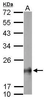 Sample (50 ug of whole cell lysate) A: mouse brain 12% SDS PAGE GTX108600 diluted at 1:1000