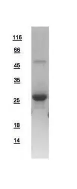 10ug of GTX108605-pro RAB5A recombinant protein analyzed using SDS-PAGE and stained with coomassie blue and captured by black and white camera.