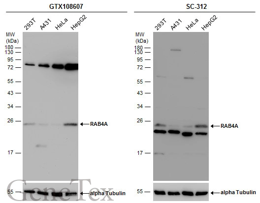 Various whole cell extracts (30 μg) were separated by 12% SDS-PAGE, and the membranes were blotted with RAB4A antibody (GTX108607) diluted at 1:500 and competitor's antibody (SC-312) diluted by 1:200.