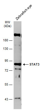 Zebrafish tissue extract (30 ug) was separated by 7.5% SDS-PAGE,and the membrane was blotted with STAT3 antibody (GTX108630) diluted at 1:1000. The HRP-conjugated anti-rabbit IgG antibody (GTX213110-01) was used to detect the primary antibody.