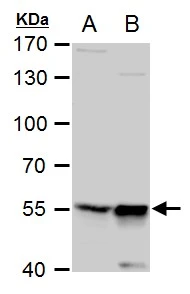 TdT antibody [C1C3] detects TdT protein by western blot analysis. A. 30 ug Jurkat whole cell extract B. 30 ug Jurkat nuclear extract 7.5 % SDS-PAGE TdT antibody [C1C3] (GTX108697) dilution: 1:500