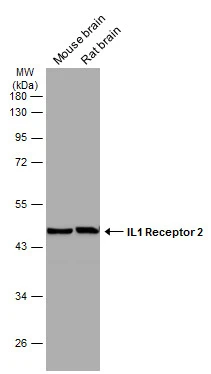 Various tissue extracts (50 μg) were separated by 10% SDS-PAGE, and the membrane was blotted with IL1 Receptor 2 antibody [N3C3] (GTX108702) diluted at 1:1000. The HRP-conjugated anti-rabbit IgG antibody (GTX213110-01) was used to detect the primary antibody.