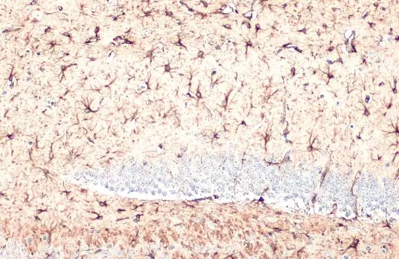 Anti-GFAP antibody (GTX108711) | GeneTex