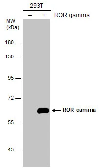 Non-transfected (–) and transfected (+) 293T whole cell extracts (30 μg) were separated by 7.5% SDS-PAGE, and the membrane was blotted with ROR gamma antibody (GTX108728) diluted at 1:1000.