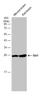 Various tissue extracts (50 μg) were separated by 12% SDS-PAGE, and the membrane was blotted with Dlx1 antibody [N1C3-2] (GTX108804) diluted at 1:1000. The HRP-conjugated anti-rabbit IgG antibody (GTX213110-01) was used to detect the primary antibody.
