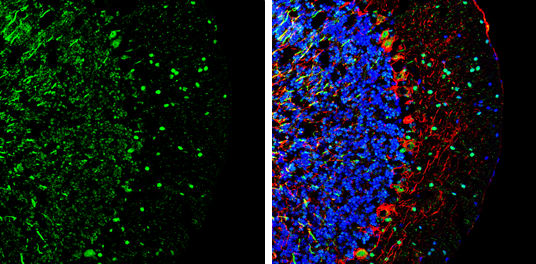 DLX1 antibody [N1C3-2]