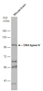 Mouse tissue extract (50 μg) was separated by 7.5% SDS-PAGE, and the membrane was blotted with DNA ligase IV antibody (GTX108820) diluted at 1:500.