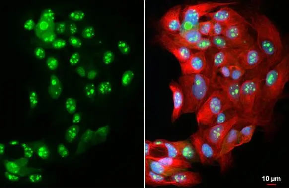 DNA ligase IV antibody detects DNA ligase IV protein at nucleus and nucleolus by immunofluorescent analysis. Sample: MCF-7 cells were fixed in 4% paraformaldehyde at RT for 15 min. Green: DNA ligase IV stained by DNA ligase IV antibody (GTX108820) diluted at 1:500. Red: alpha Tubulin, a cytoskeleton marker, stained by alpha Tubulin antibody [GT114] (GTX628802) diluted at 1:1000. Blue: Fluoroshield with DAPI (GTX30920).