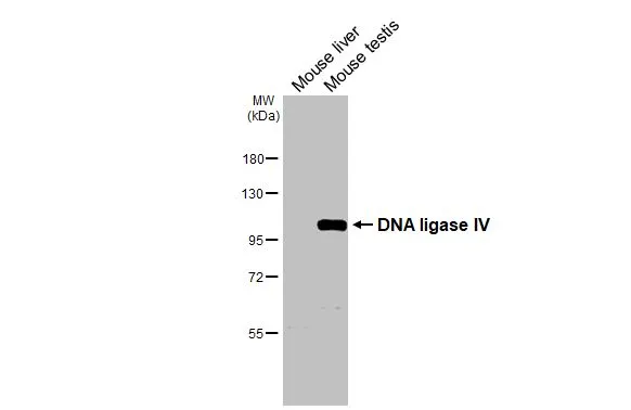 Various tissue extracts (50 μg) were separated by 7.5% SDS-PAGE, and the membrane was blotted with DNA ligase IV antibody (GTX108820) diluted at 1:1000. The HRP-conjugated anti-rabbit IgG antibody (GTX213110-01) was used to detect the primary antibody.